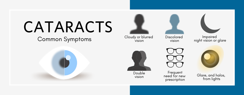  Common symptoms of cataracts