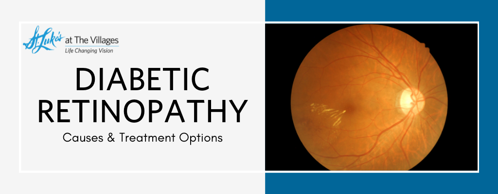 retina retinopathy treatment options 